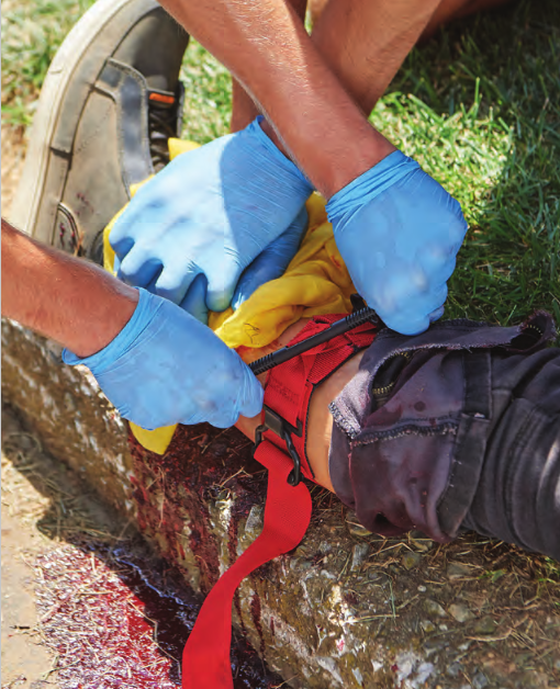 bleeding leg with tourniquet, FAST course